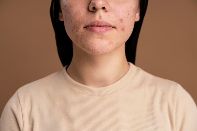 asa